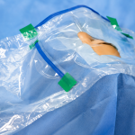 Detailed view of surgical drape bag opening maintained by a flexible aluminum shaping strip